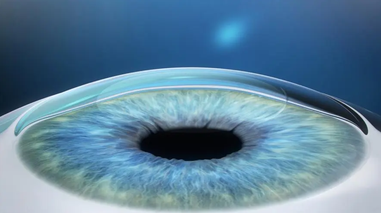 近视手术动了眼睛的哪个部分？会伤害视网膜吗？