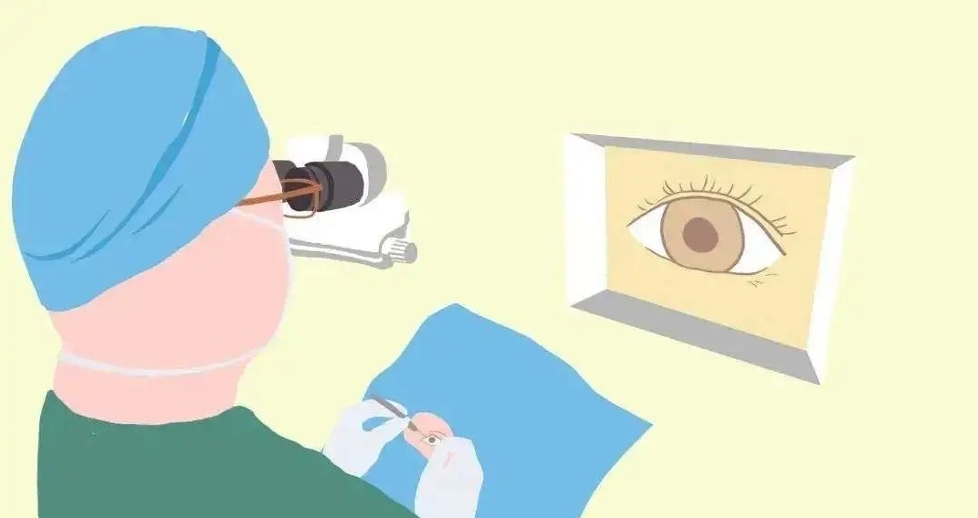 近视手术是否会损害视网膜吗？
